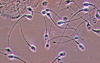 sperma di alta qualità