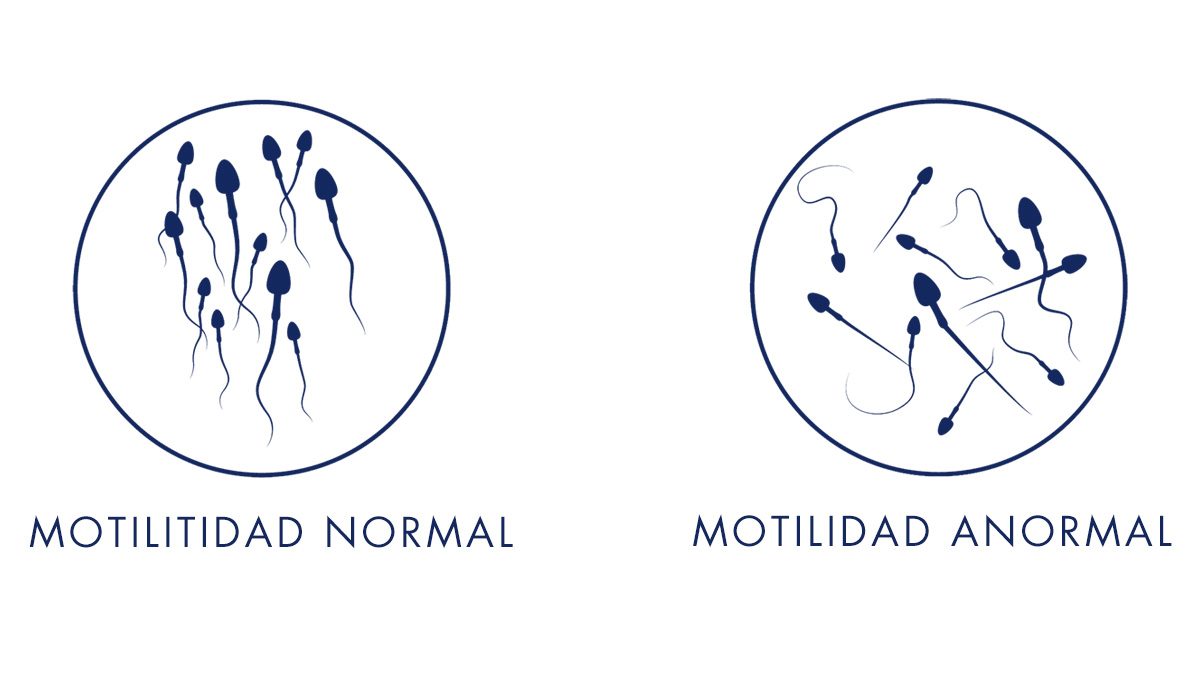 Motilidad en Espermatozoides